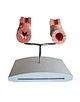 Chronic bronchitis model for patient education